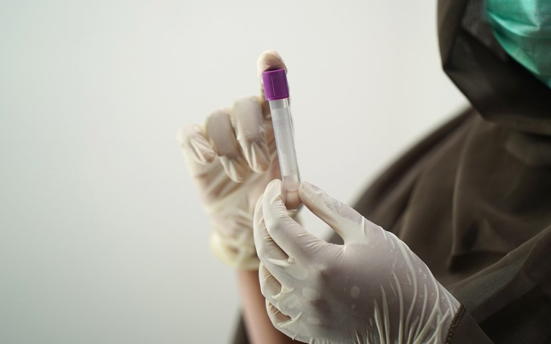 les tests de dépistage